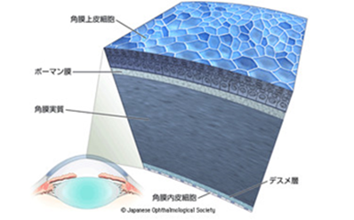コンタクトレンズ説明