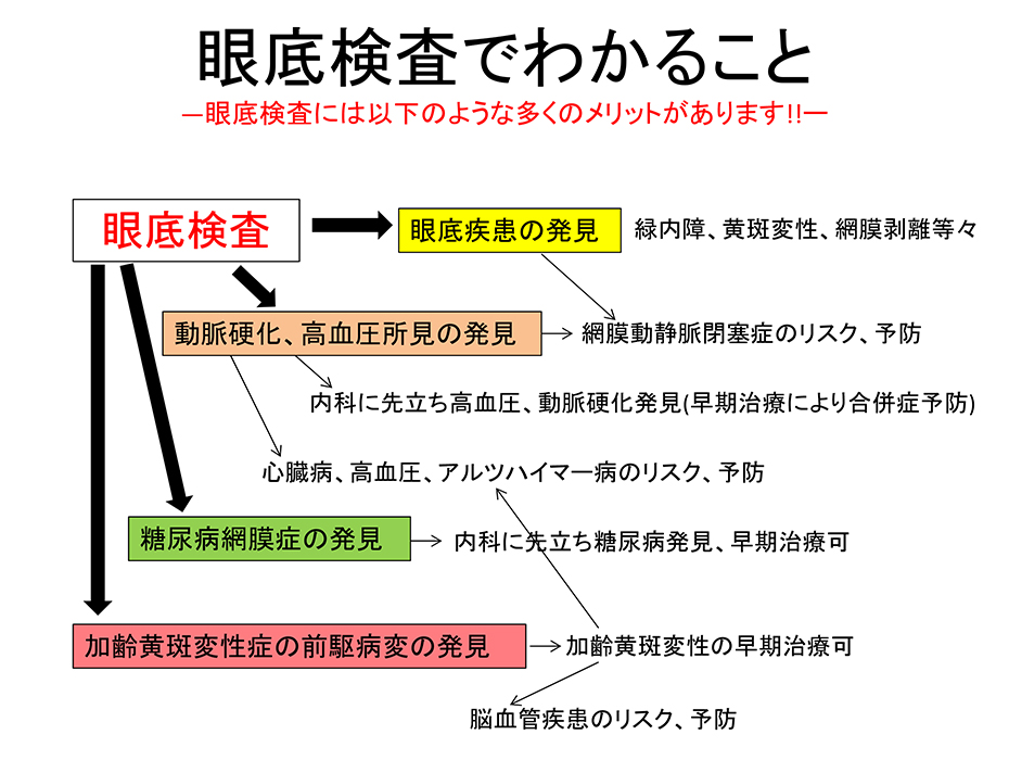 眼底検査でわかること