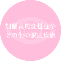 加齢黄斑変性症やその他の眼底疾患